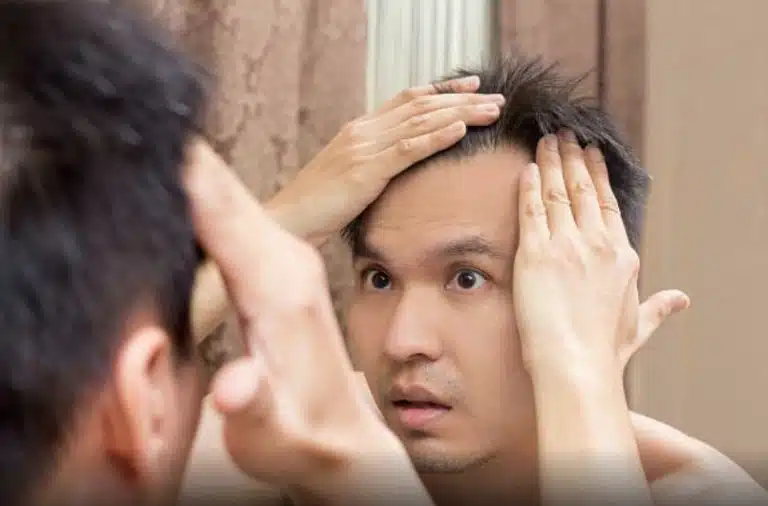 acne cheveux problème perte cheveux