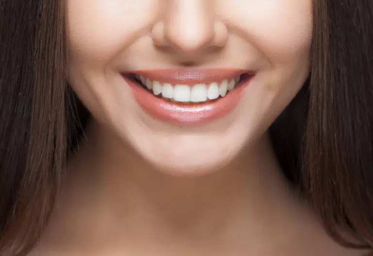 belles dents saines