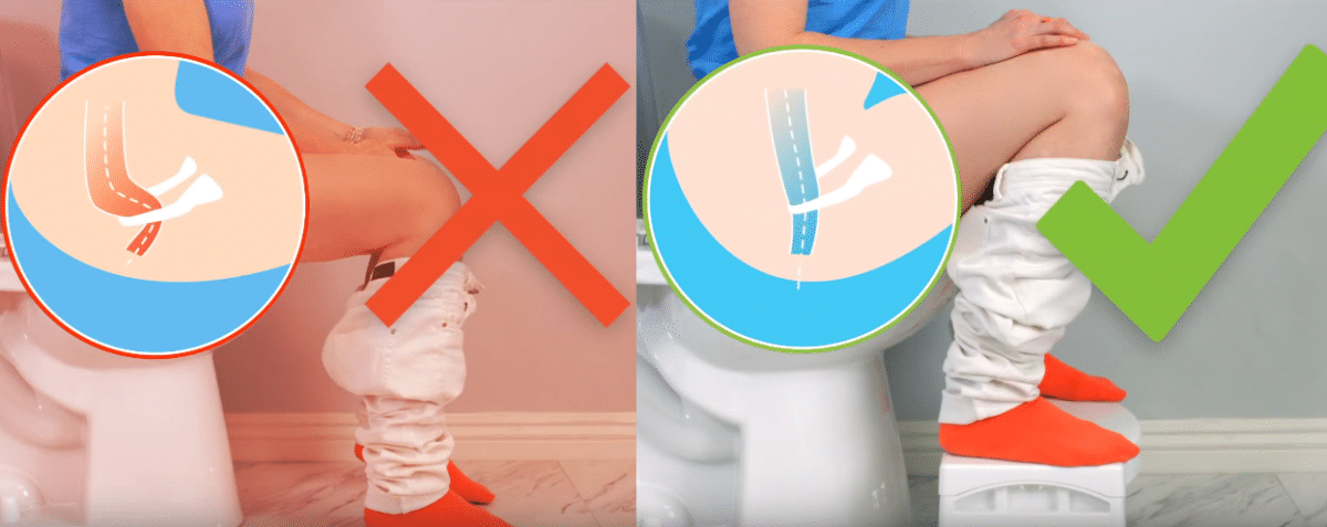 traitement des h&eacute;morro&iuml;des bonne position toilettes