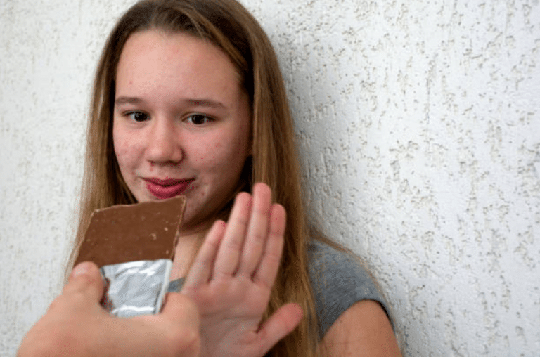 chocolat acn&eacute; aliments qui donnent des boutons