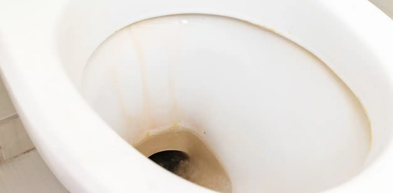 toilettes sales tartre