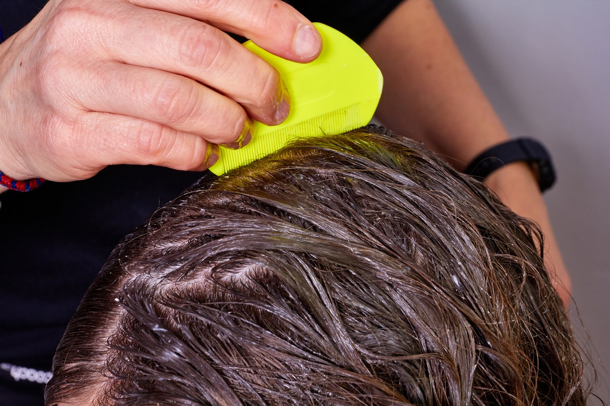 Comment Faire Pour Pas Avoir De Poux