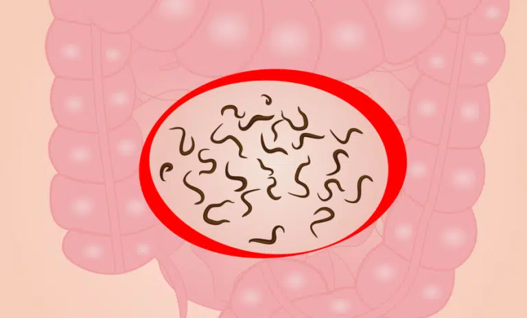 vers intestinaux