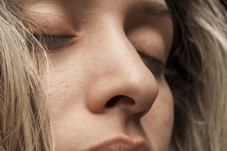 visage femme pores dilat&eacute;s