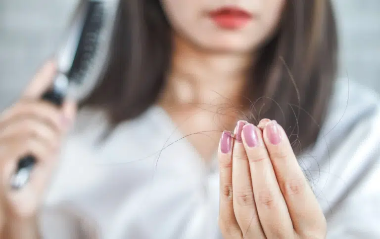 chute des cheveux perte capillaire