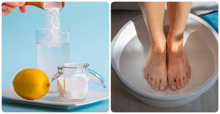 bicarbonate rem&egrave;des