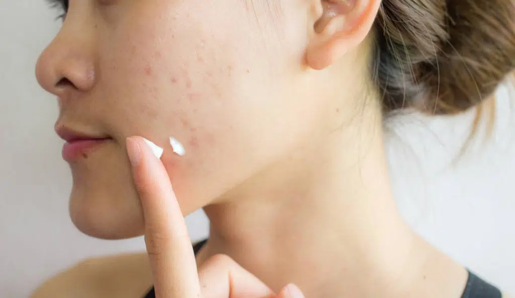 dentifrice sur un bouton