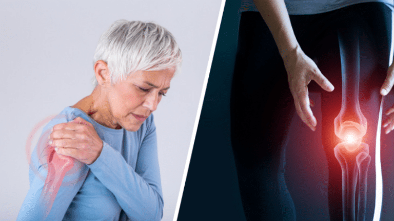arthrose douleurs articulaires &eacute;paule genou