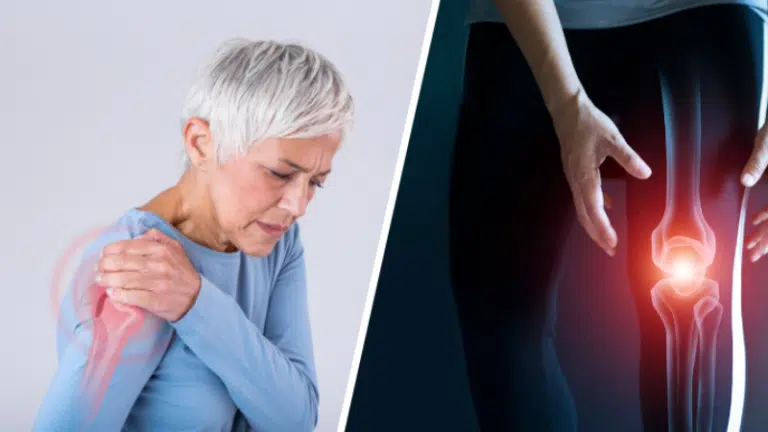 arthrose douleurs articulaires &eacute;paule genou