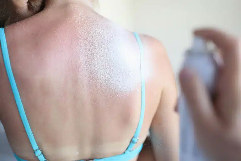 cr&egrave;me solaire protection soleil &eacute;t&eacute; taches v&ecirc;tement