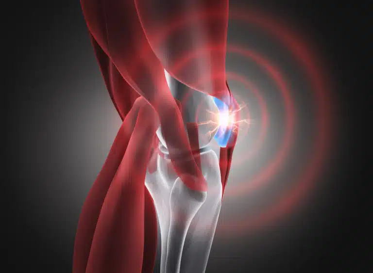 douleurs genou arthrite arthrose