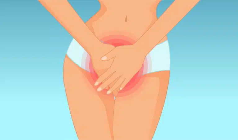 vagin sexe de femme douleurs d&eacute;mangeaisons mycose s&eacute;cheresse vaginale