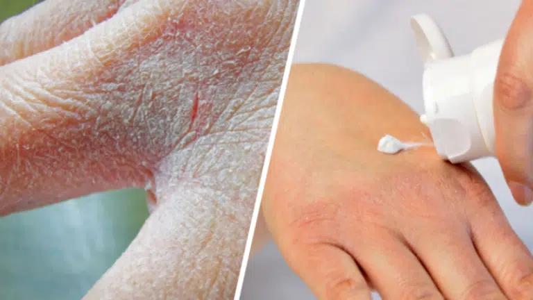mains s&egrave;ches et ab&icirc;m&eacute;es cr&egrave;me