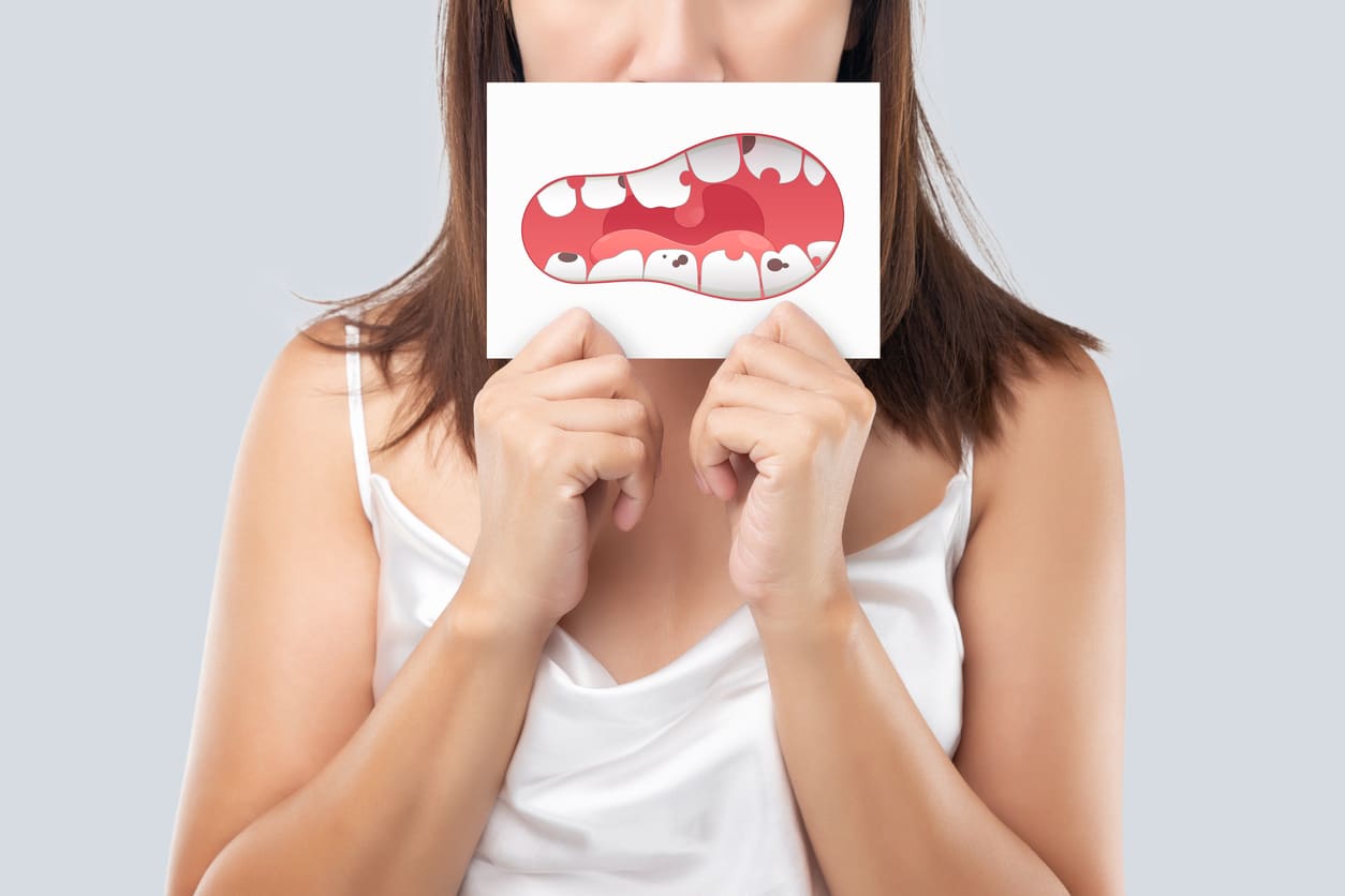 dents ab&icirc;m&eacute;es caries