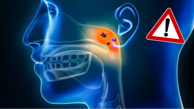 Cancer du nasopharynx tumeurs ou cellules canc&eacute;reuses produits ou objets canc&eacute;rig&egrave;nes du quotidien