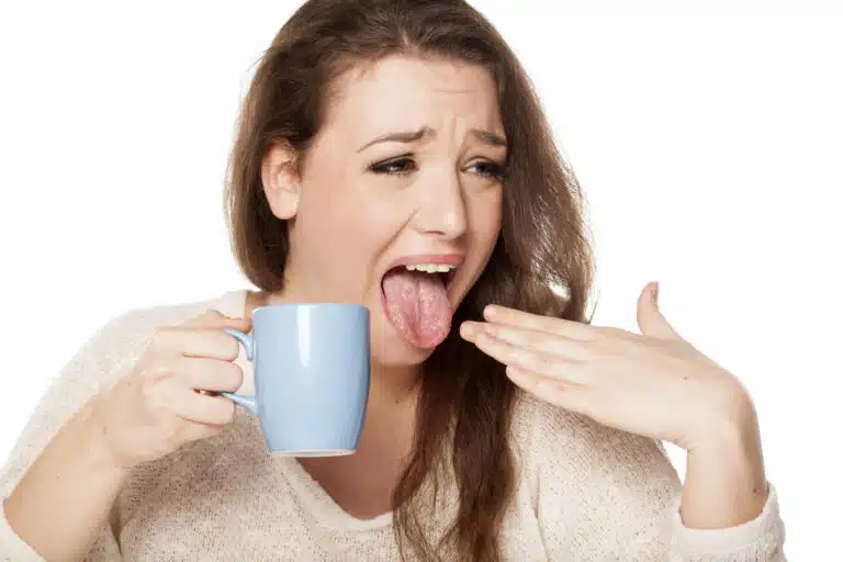 langue br&ucirc;l&eacute;e boisson trop chaude