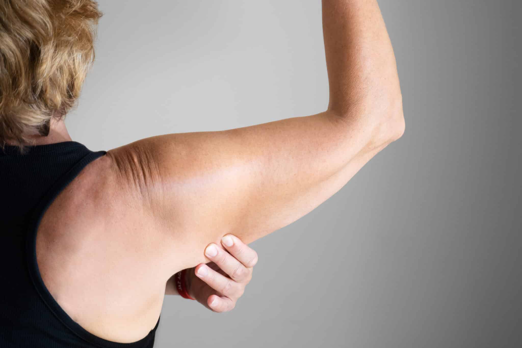 des bras chauve-souris qui pendent