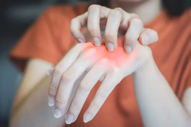 &eacute;ruption cutan&eacute;e allergie peau qui gratte d&eacute;mangeaisons tiraillements