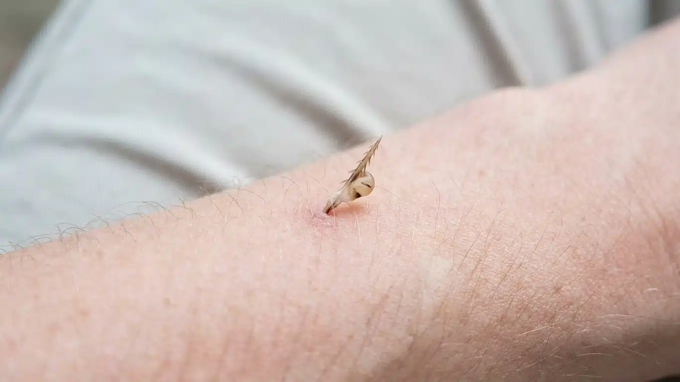 Mon grand-p&egrave;re ne sortait jamais la pince &agrave; &eacute;piler apr&egrave;s une piq&ucirc;re d'abeille et ce n'est pas parce qu'il supportait la do...