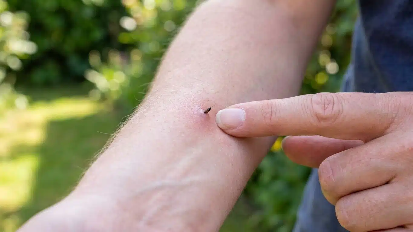 Mon grand-p&egrave;re ne sortait jamais la pince &agrave; &eacute;piler quand un dard d'abeille restait plant&eacute; et ce n'est pas par n&eacute;gligence
